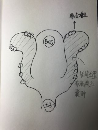 《魔兽世界》8.3H恩佐斯的外壳攻略